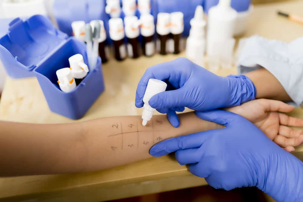Test allergologici: tipi, preparati ed effetti collaterali