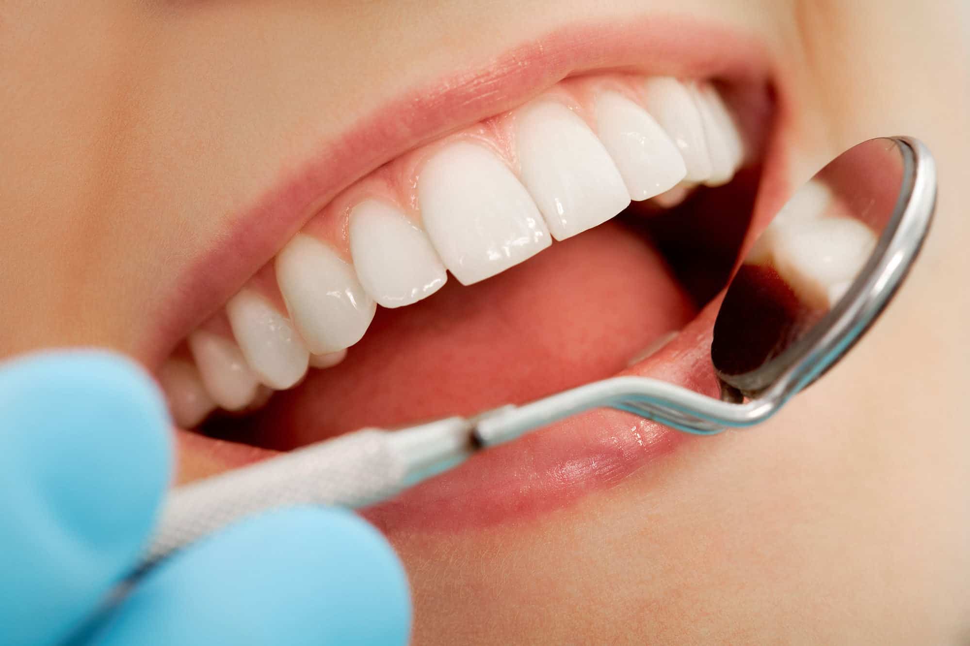Memahami Tanda dan Punca Gigi Bijak yang Menyakitkan
