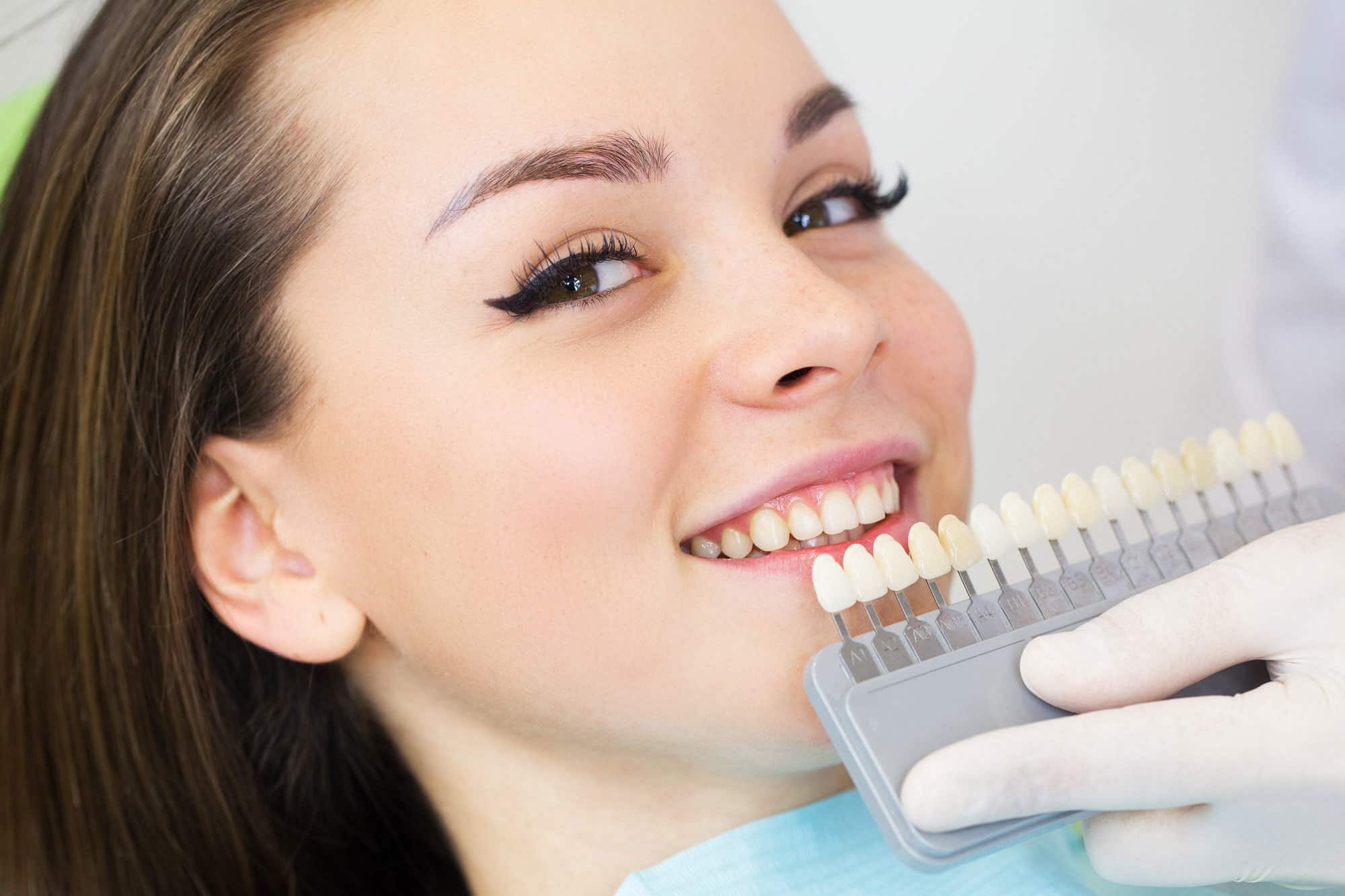 Всичко, което трябва да знаете за зъбните фасети