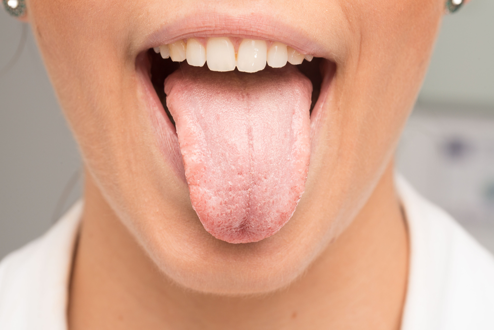 白舌？これらの9つの原因とそれを克服する方法！