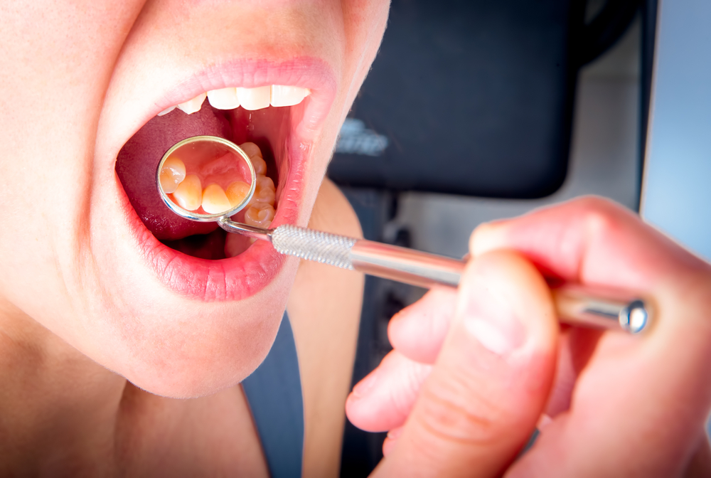口蓋の痛みの10の原因とそれを安全に治療する方法