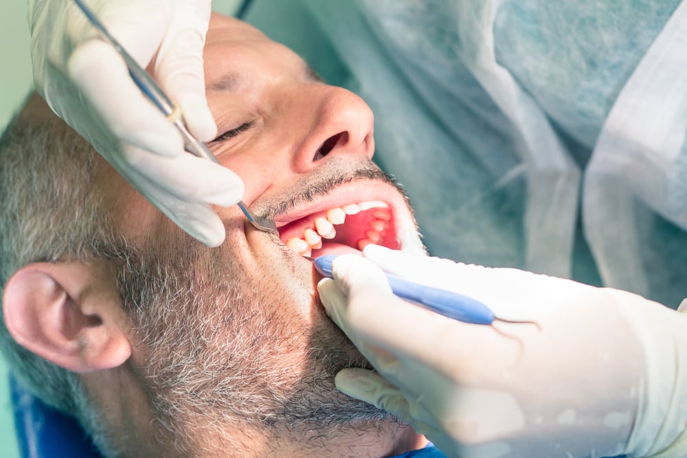 Trattamento dopo l'estrazione del dente, ecco cosa puoi e cosa non puoi fare