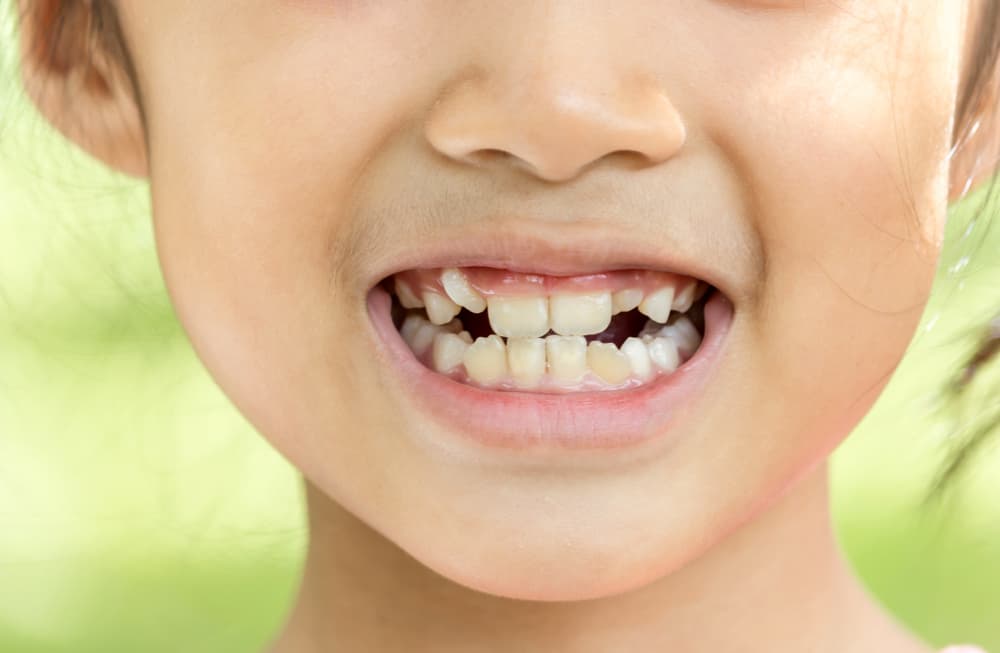 Зъби от женшен, по -добре ли е да го оставите или да го извадите?