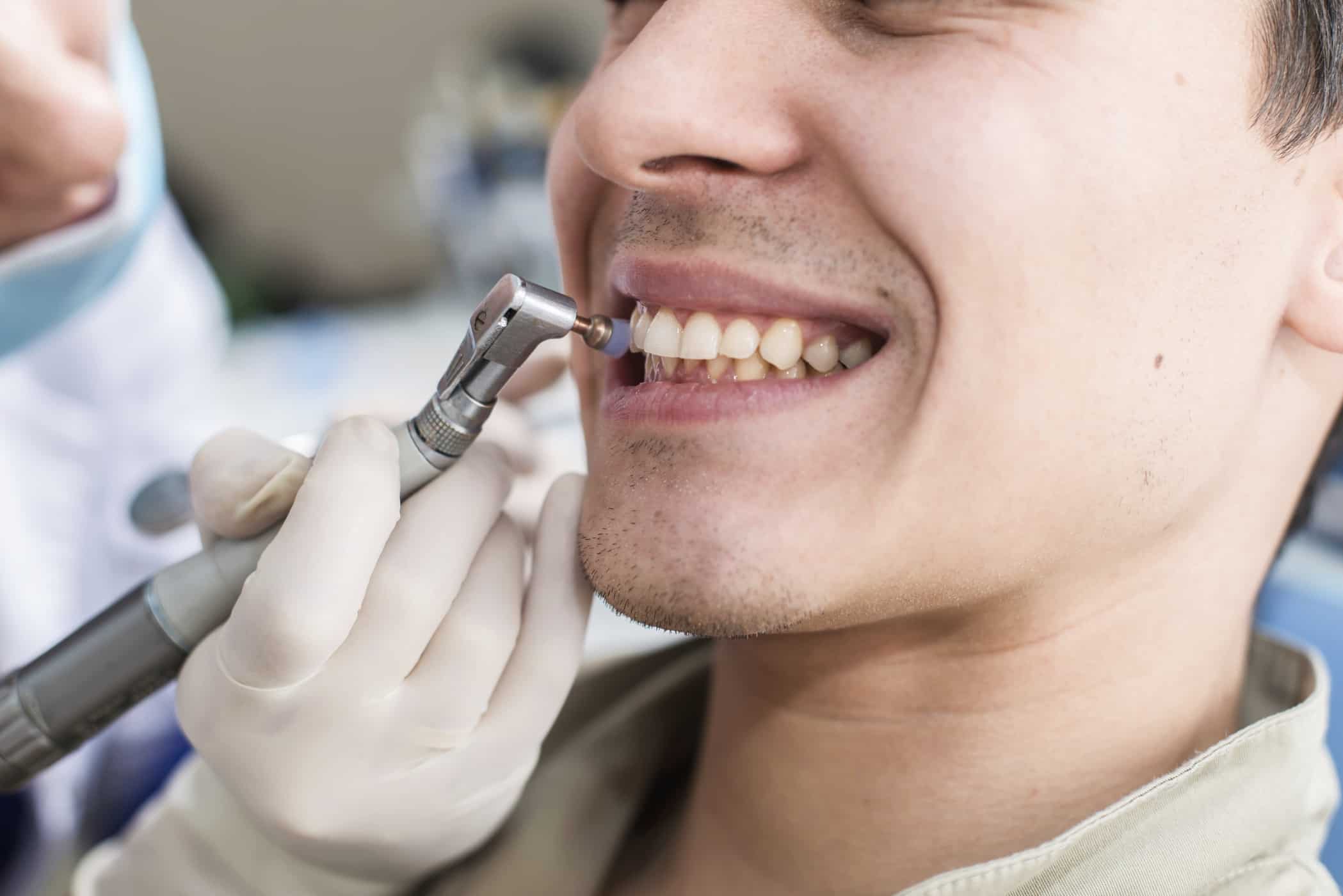 7 начина да изправите зъбите си, които можете да опитате при лекаря
