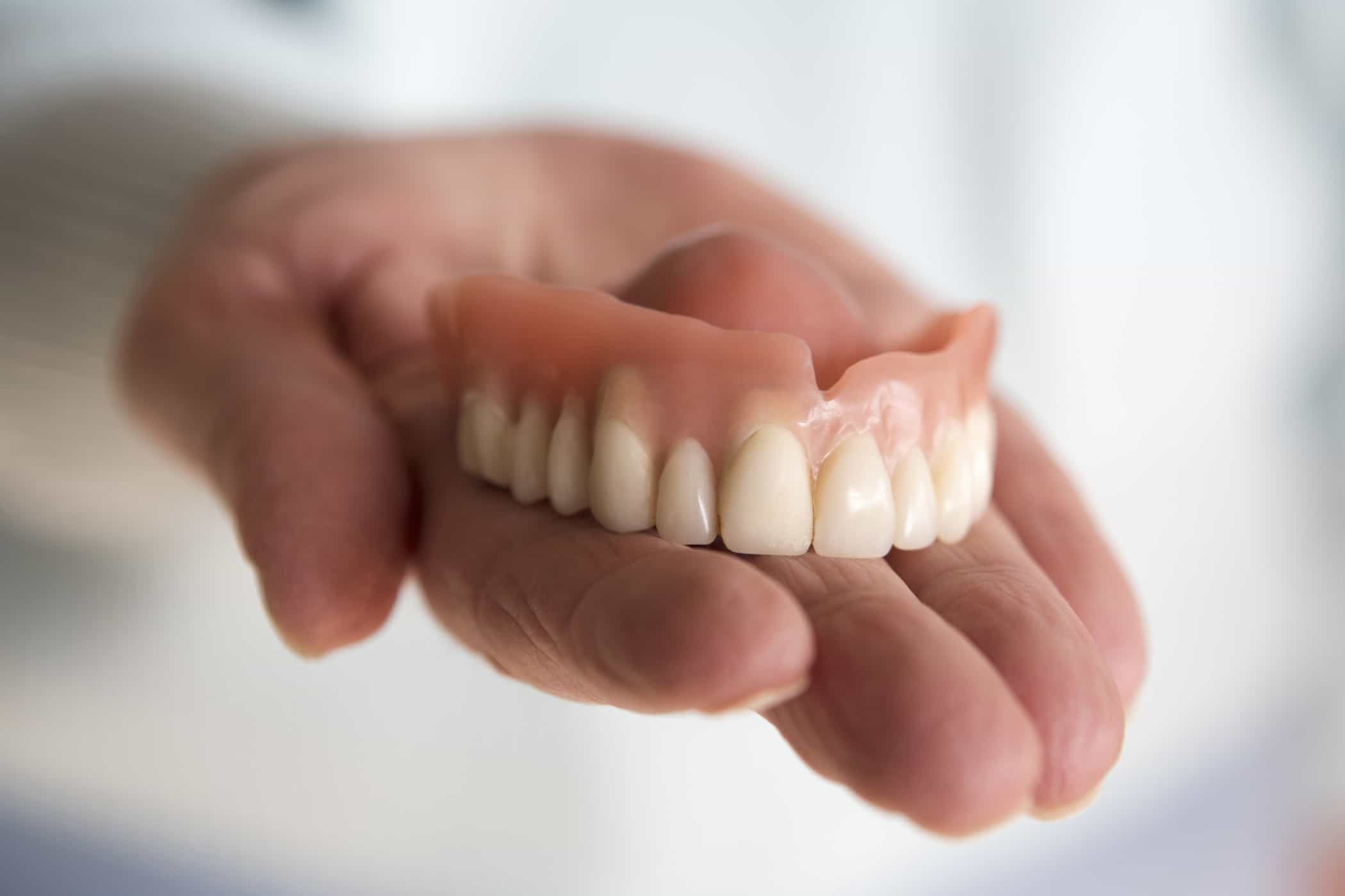 عملية تركيب طقم الأسنان من البداية إلى النهاية التي تحتاج إلى معرفتها