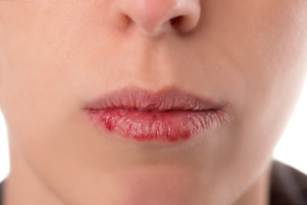 乾燥した唇を防ぎ、克服するための効果的な方法