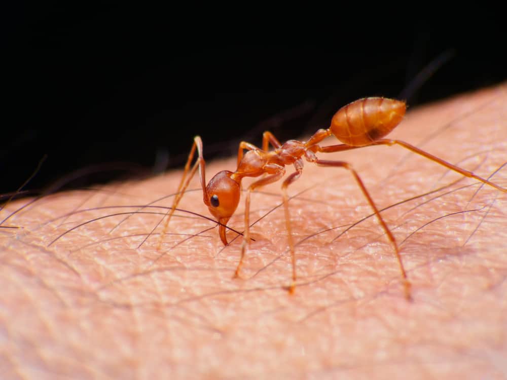 الخطوات الصحيحة للتغلب على الألم والحكة بسبب لدغات النمل الناري