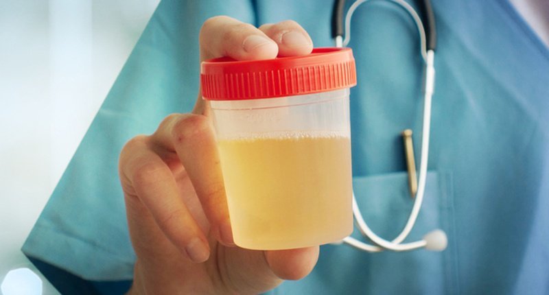 Confuso sulla differenza tra liquido amniotico e urina? Ecco il modo facile