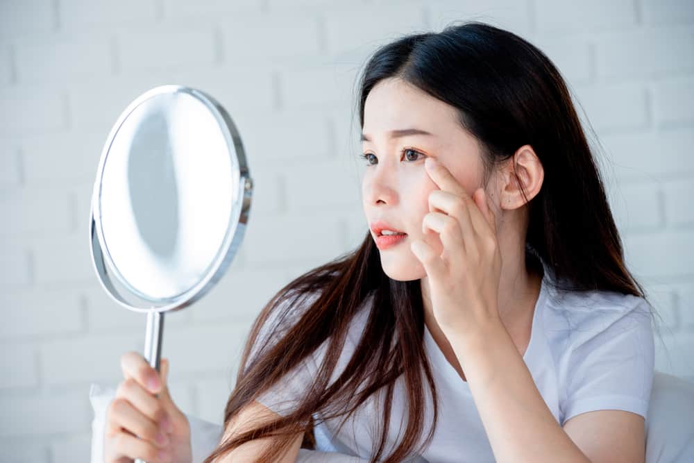 Tipi di acne e varie cause
