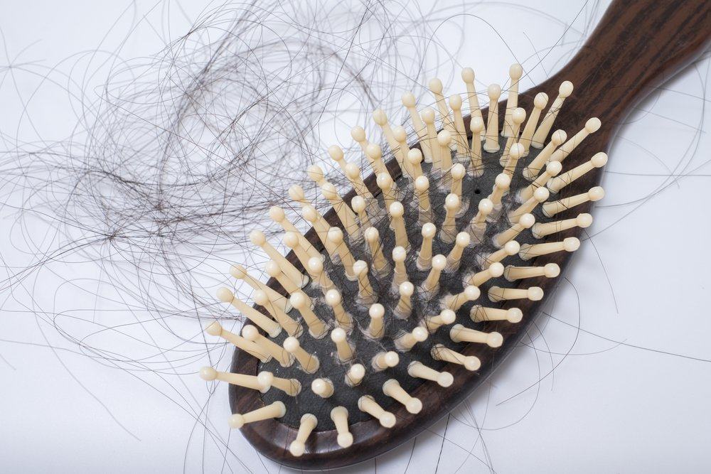 Queste sono le varie cause di caduta dei capelli che non ti aspetti
