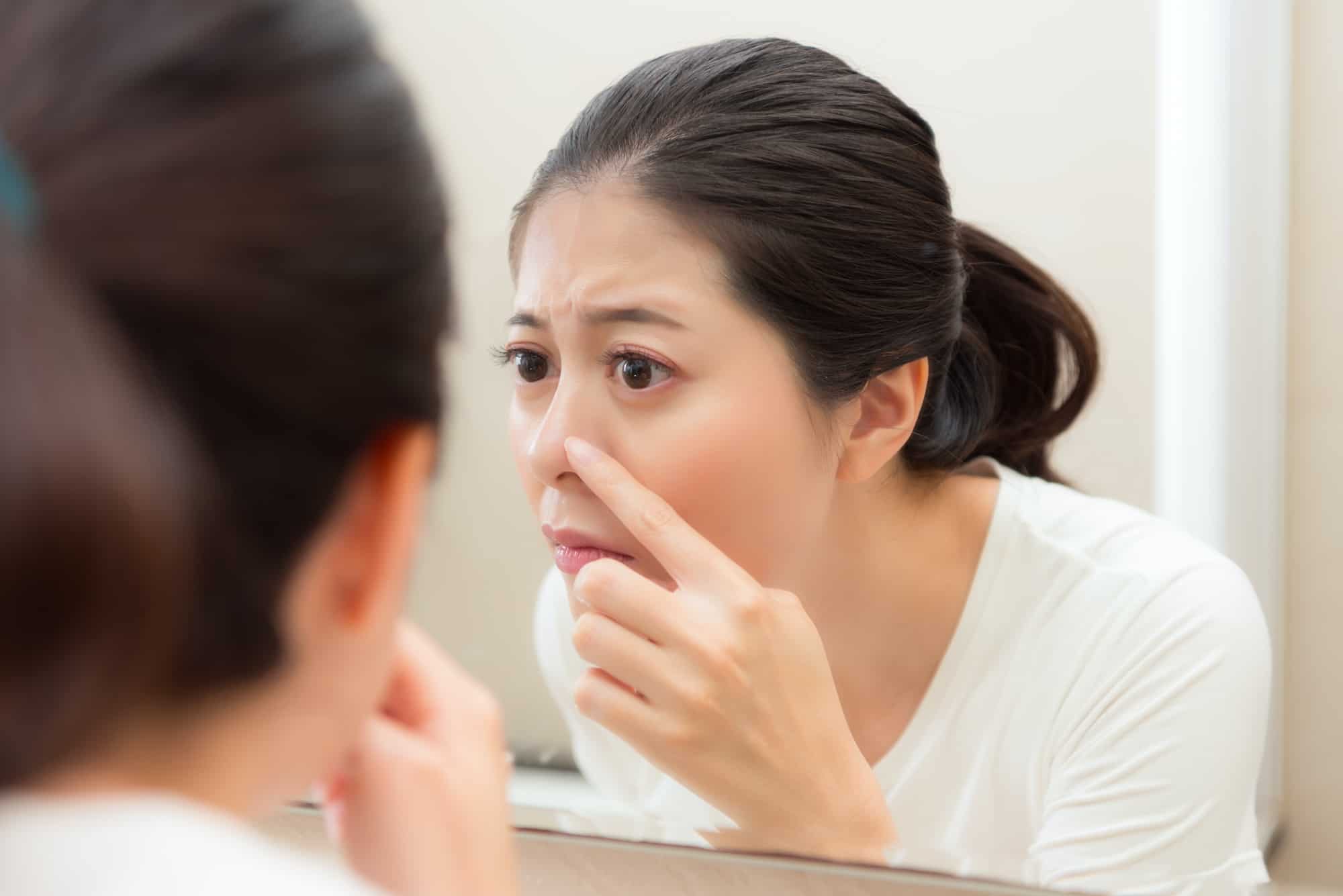 鼻の厄介なにきびを克服するための原因と簡単な方法