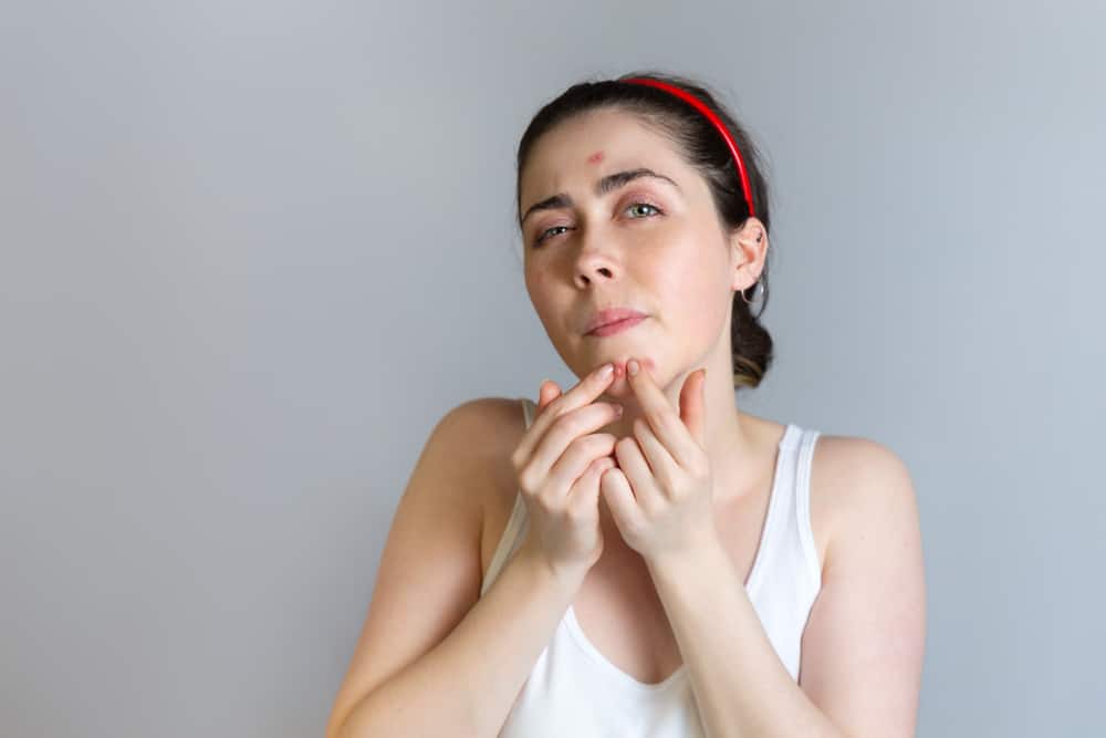 Riconoscere le cause dell'acne sul mento e come superarla