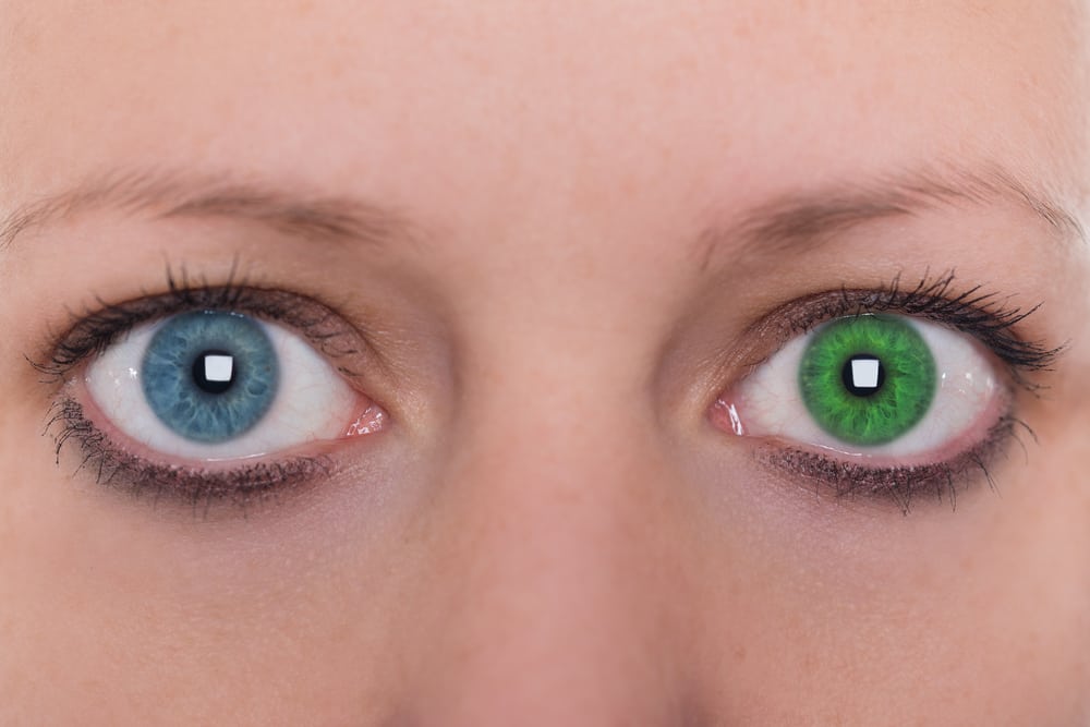 虹彩異色症、あなたの目が異なる色の場合