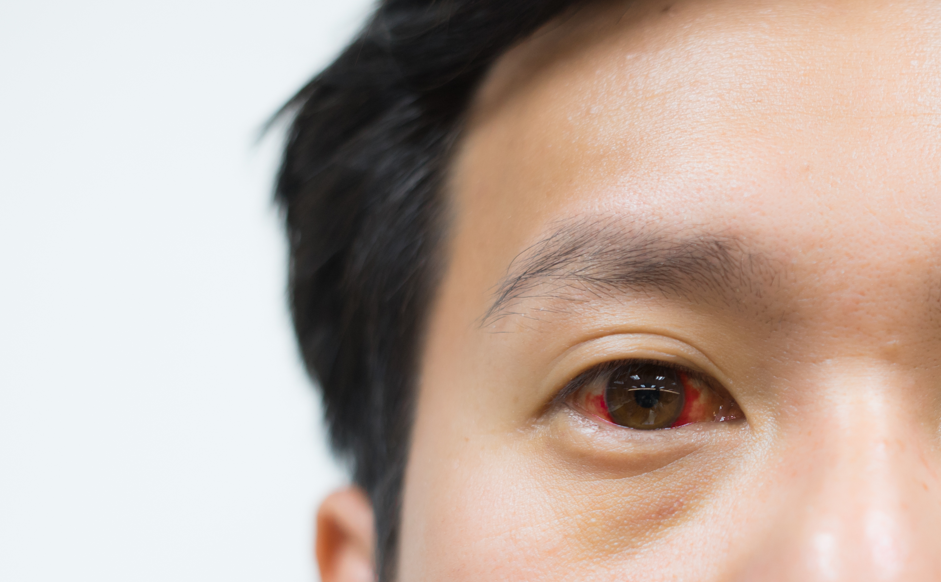 Adakah benar mata anda dapat berdarah jika anda bermain alat terlalu lama?