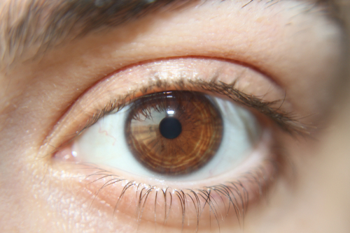 4 аномалии, които могат да възникнат в зениците на очите