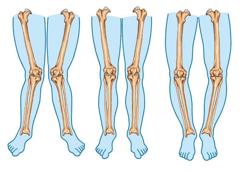 6 упражнения за подобряване на формата на X крака