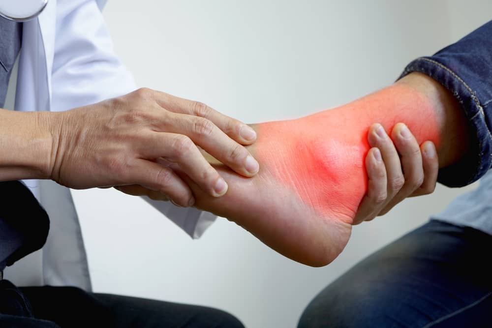 Punca Gout dan Faktor Yang Meningkatkan Risiko
