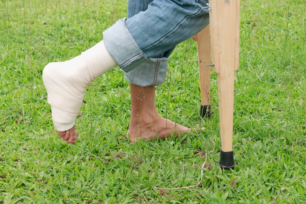 สิ่งสำคัญที่ควรรู้เกี่ยวกับกระดูกหักและแขนขา