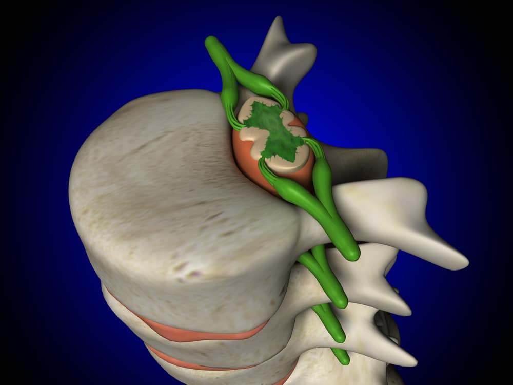 脊髄の解剖学、機能、および病気を知る