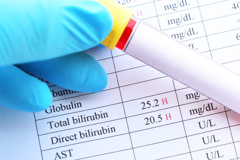 Билирубин и тест за билирубин
