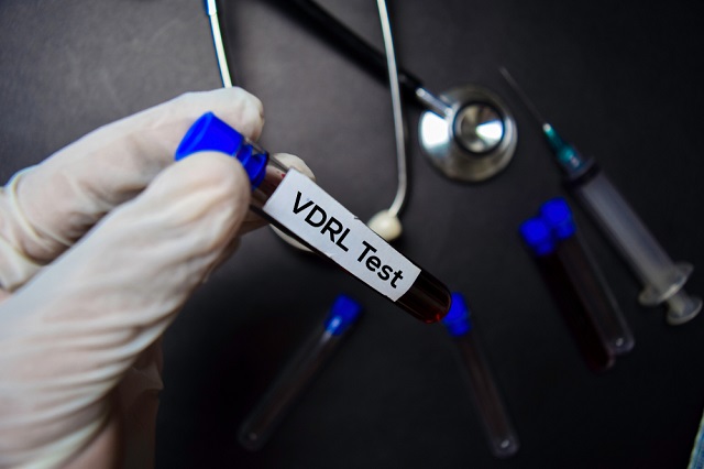 الكشف عن مرض الزهري باستخدام اختبار VDRL: كيف يعمل ، والنتائج ، والمخاطر