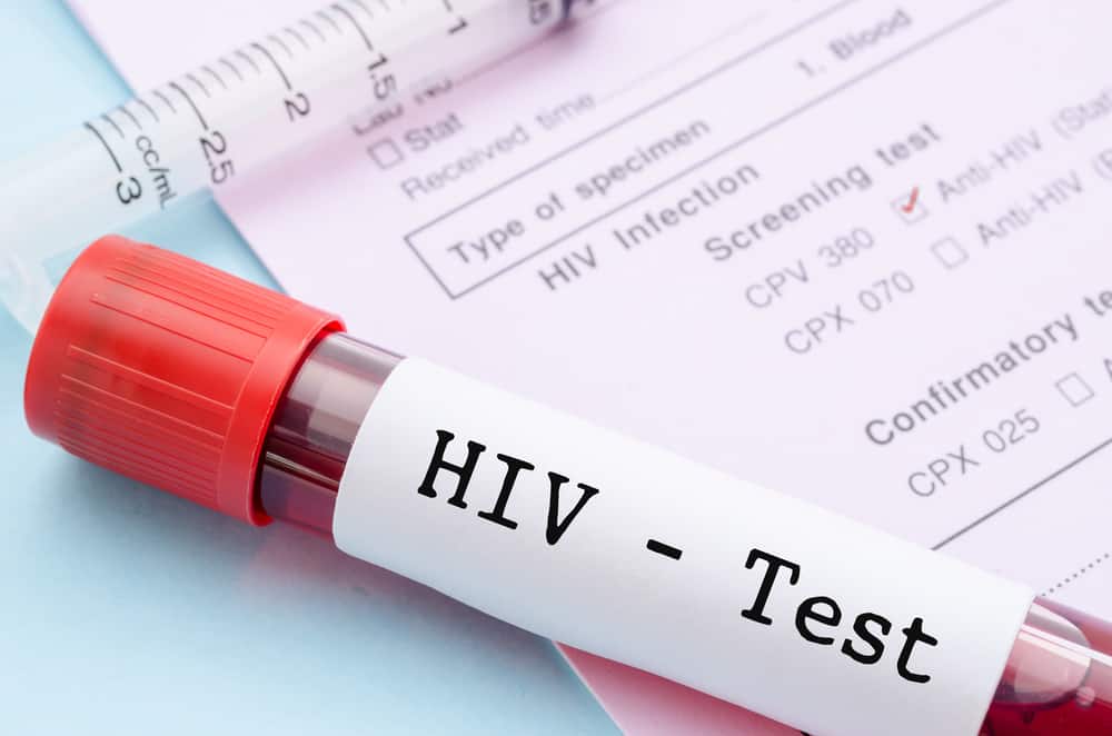 Познаване на статуса на ХИВ от отрицателни, реактивни и положителни резултати от теста