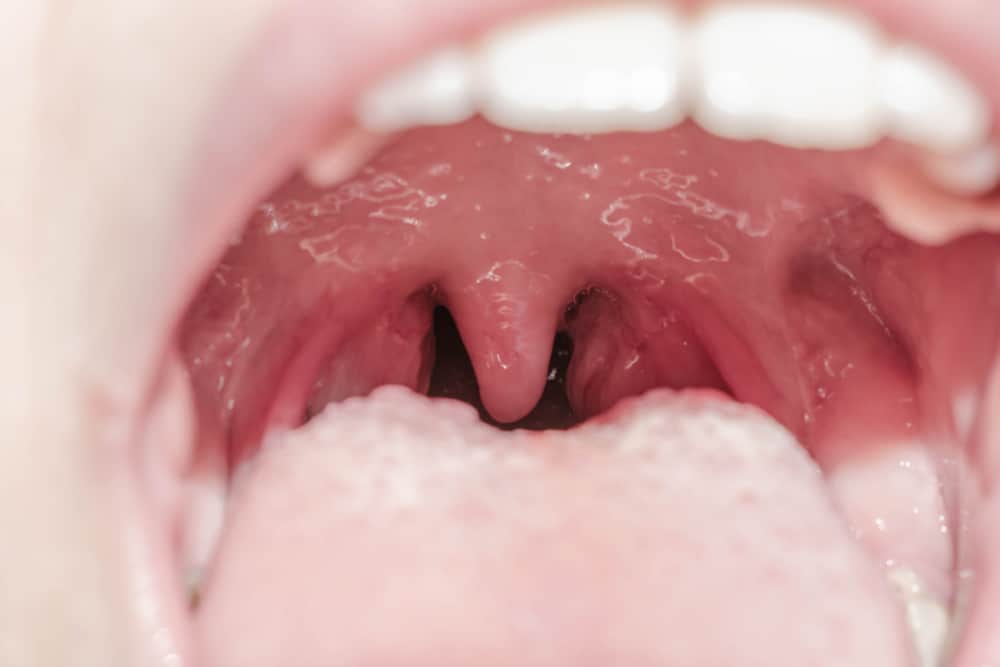Conoscere le tonsille, piccoli organi che svolgono un ruolo importante nella lotta alle infezioni