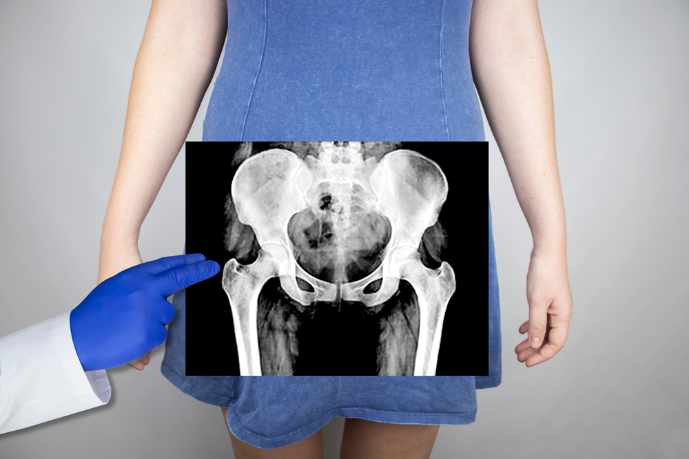 男性からの女性の骨盤の解剖学のさまざまな部分と機能のレビュー