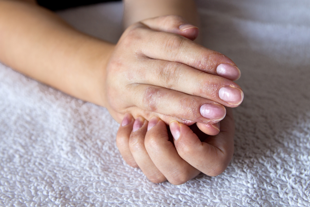 指のかゆみを引き起こす5つの健康上の問題