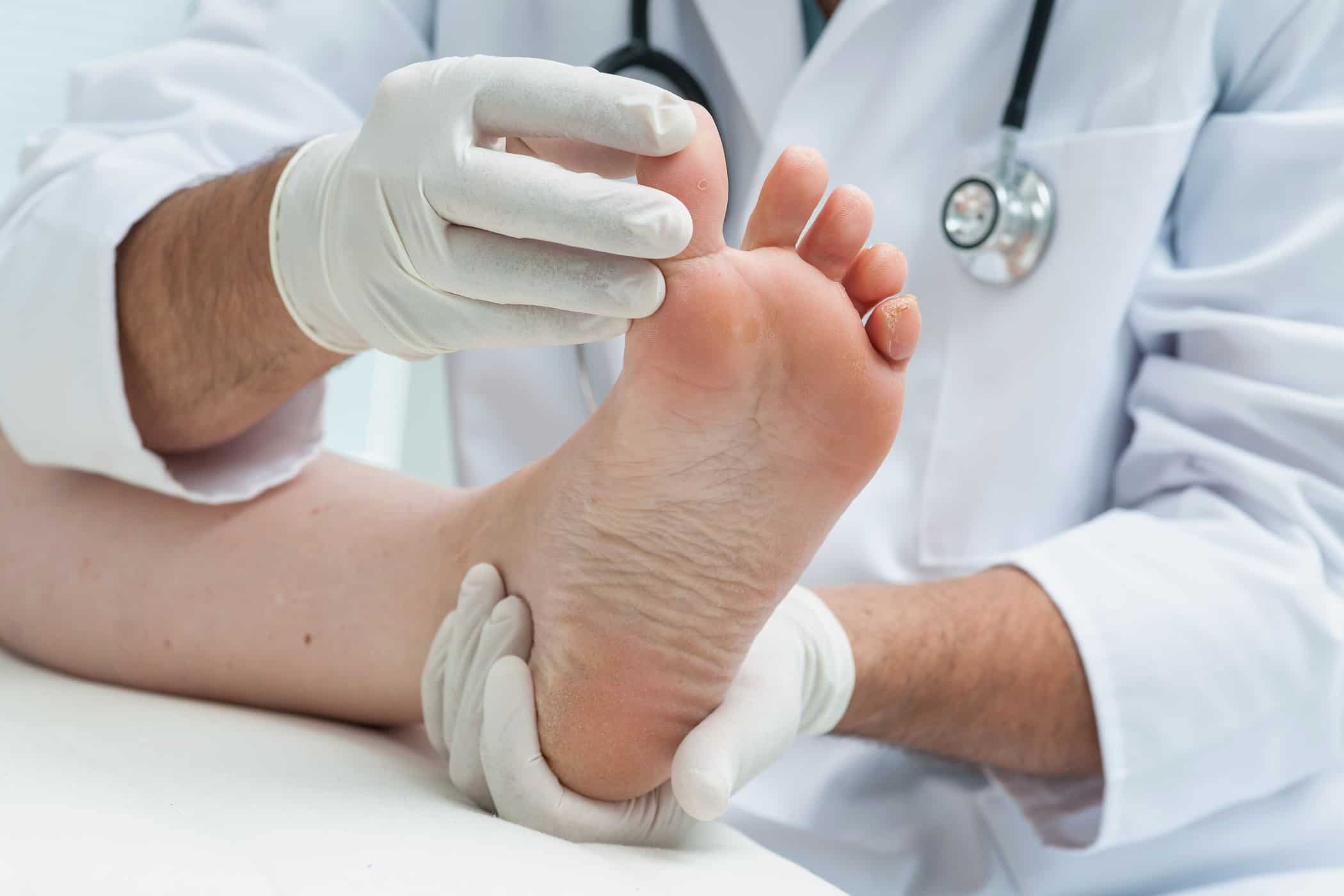 足の状態から病気を検出できますか？
