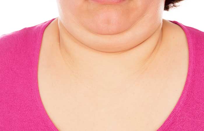 Vari modi efficaci ed efficaci per sbarazzarsi del grasso del collo (doppio mento)