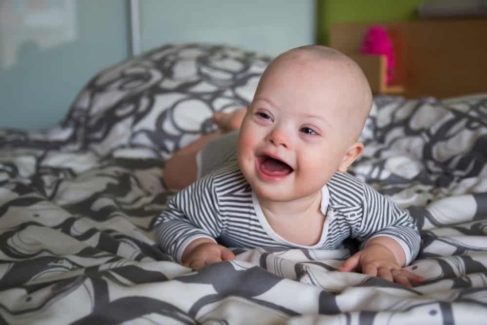 خصائص متلازمة داون عند الرضع والأطفال التي يجب مراقبتها