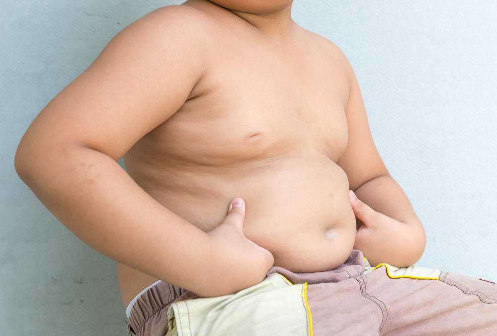 Затлъстяването при деца: симптоми, усложнения и как да се преодолее