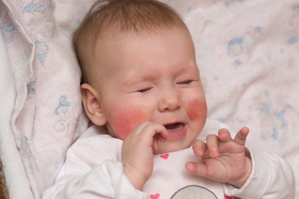 Punca pipi bayi merah, dari normal hingga perlu berhati-hati