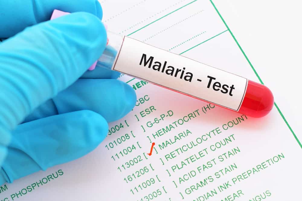 Tanda dan Gejala Malaria yang Anda Tidak Perlu Abaikan