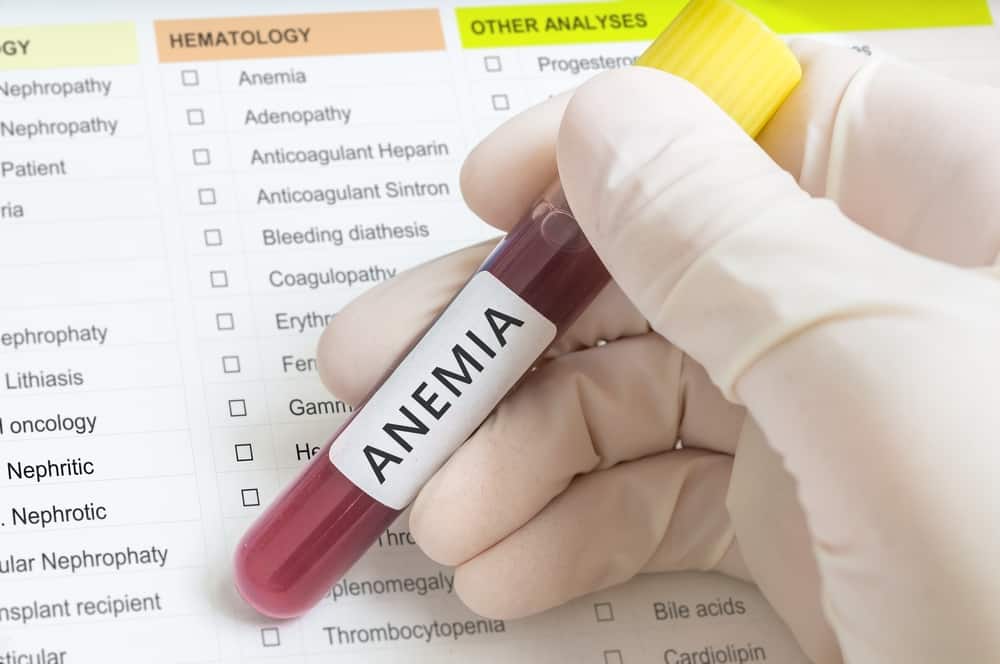 Varie opzioni di trattamento per trattare l'anemia