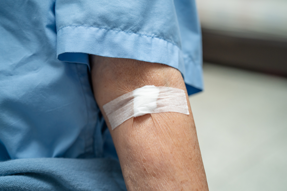 MCVのレビュー、貧血のタイプを決定するための赤血球の検査